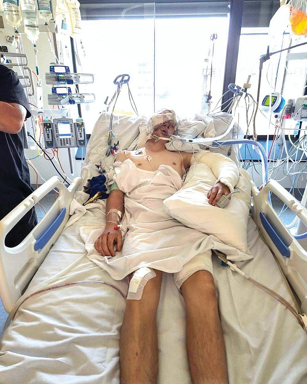 ‘Reckless’ driver gets 4 years, victim has life sentence post image